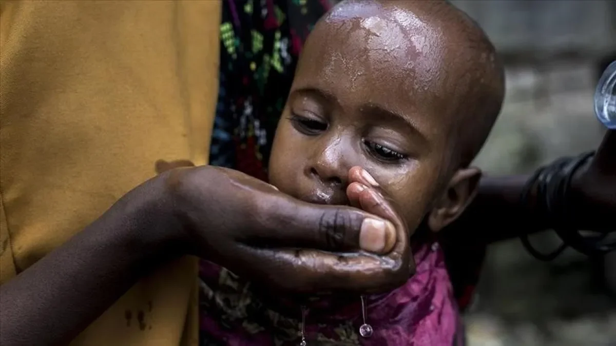 Afrika’da 25 yılın en kötü kolera salgını: 300 bini aşkın vaka, 7 binden fazla can kaybı