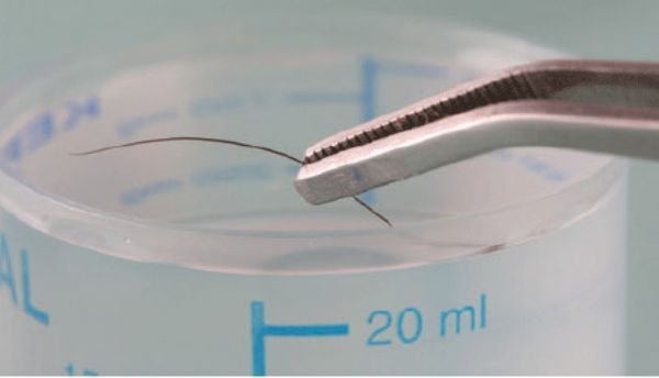 Rapor Negatif, Sorular Baki: Furkan Torlak Vakası Bize Ne Anlatıyor?