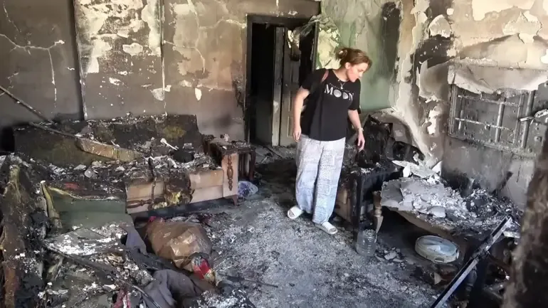 Hatay'da Yangında Yüzü ve Vücudu Yanan Adamın Tedavisi Devam Ediyor