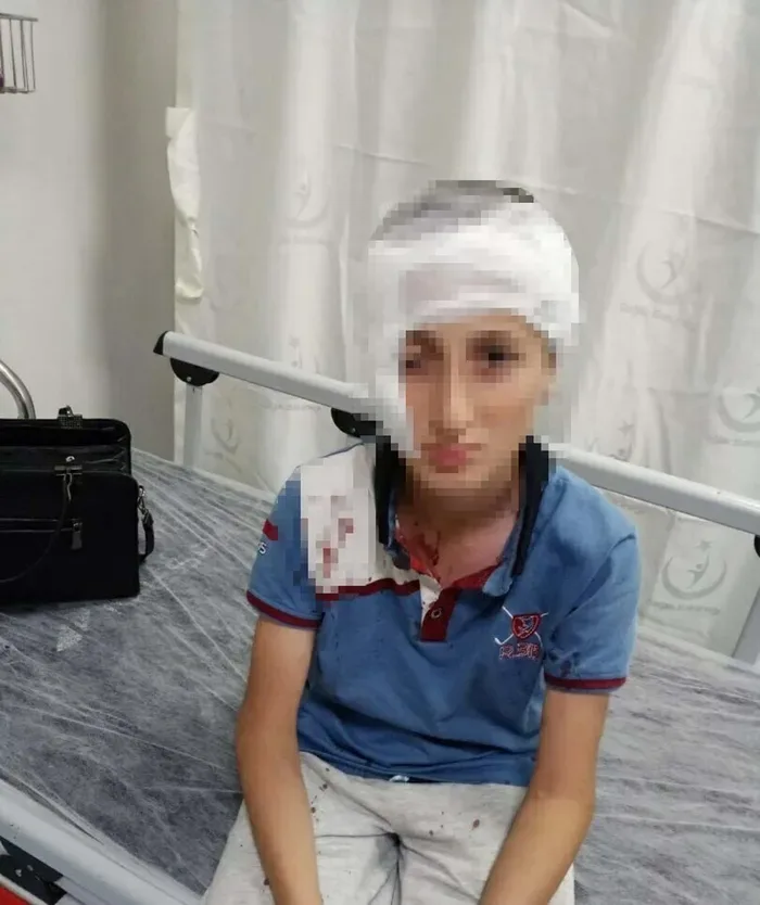 İzmir'deki köpek dehşetine ders gibi ceza: 11 yaşındaki çocuğun yüzünü parçalamıştı!