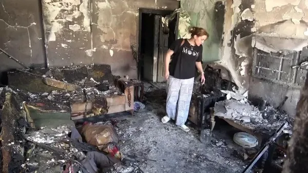 Hatay'da yangında ailesini kurtarmak isterken ağır yaralandı