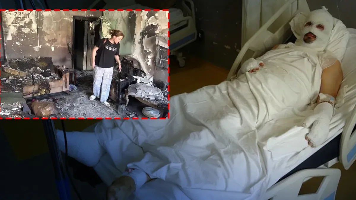 Hatay'da yangında ailesini kurtarmak isterken ağır yaralandı